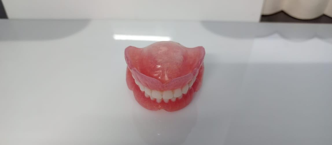 Denture full arch upper lower L642