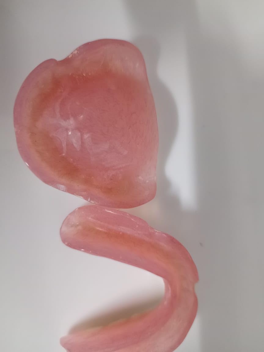 Denture full arch upper lower L642