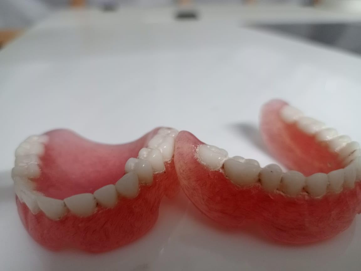 Full Set Upper & Lower Denture X650259