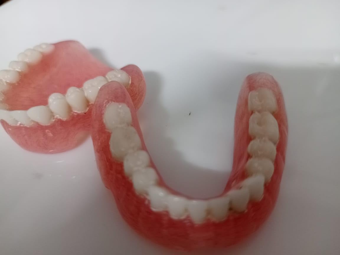 Full Set Upper & Lower Denture X650259