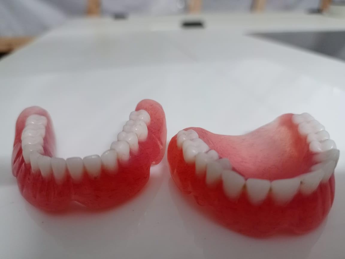 Denture full arch upper lower L642